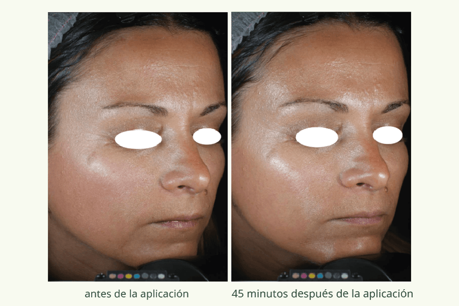 Collagene Vegetale 1-SPA