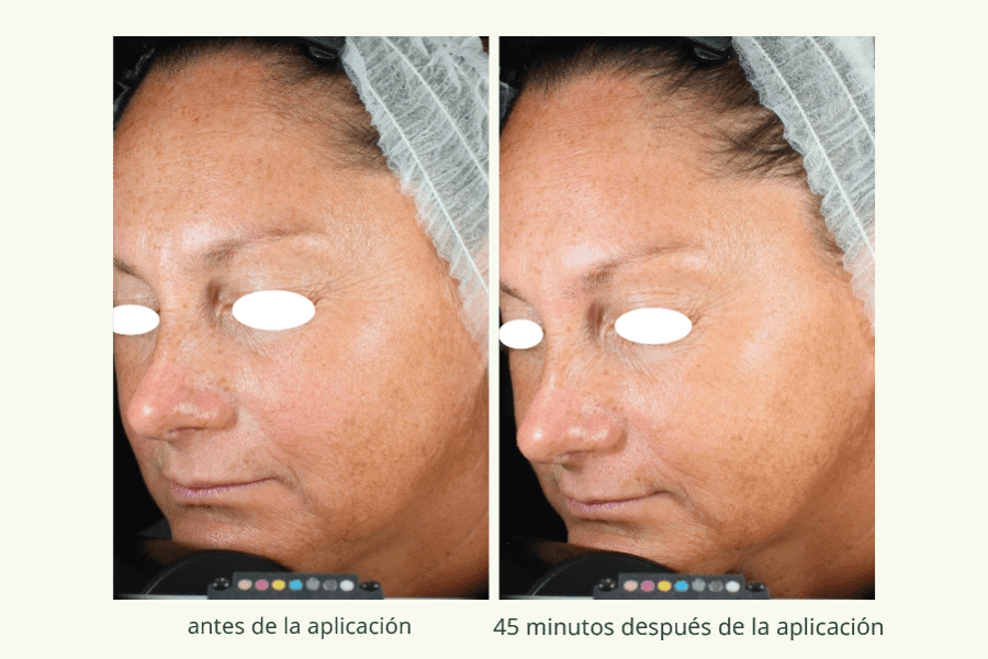 Collagene Vegetale 2- SPA