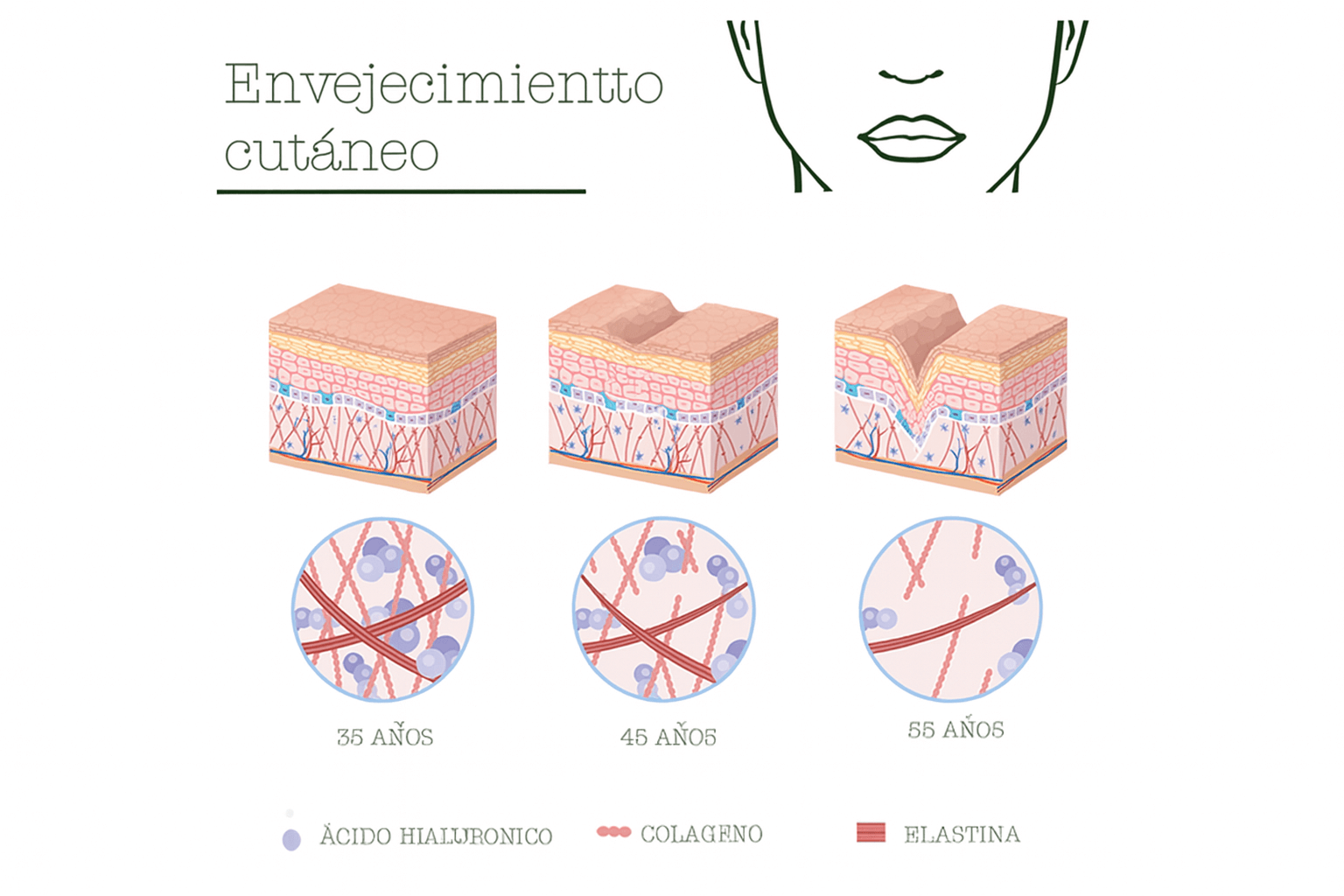 invecchiamento-spa