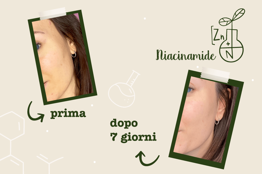 niacinamide prima e dopo_Staybiobeautyblogger (Blog)