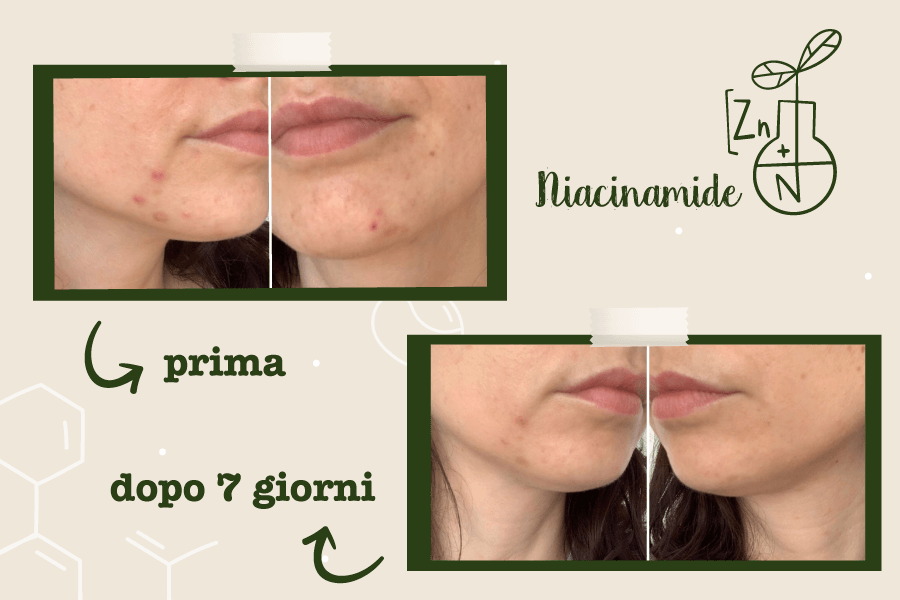 prima e dopo niacinamide_ecobioadvisor (Blog)