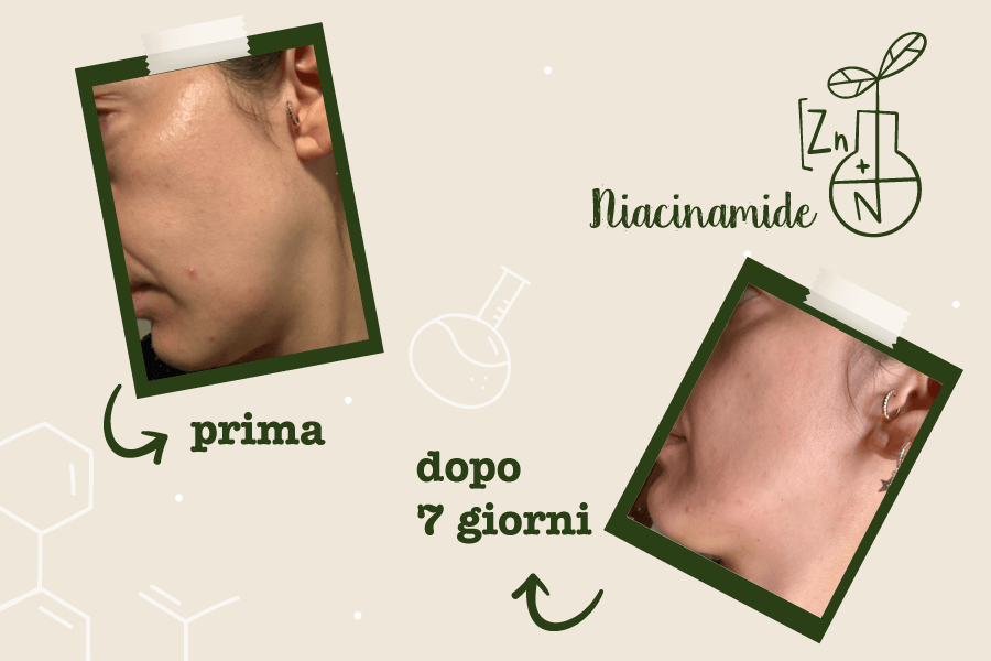 prima e dopo niacinamide_ladybiobug (blog)